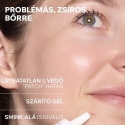 Uriage HYSÉAC Szárító gél pattanások SOS kezelésére 15 ml