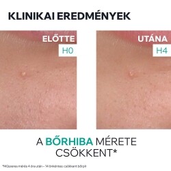 Uriage HYSÉAC Szárító gél pattanások SOS kezelésére 15 ml