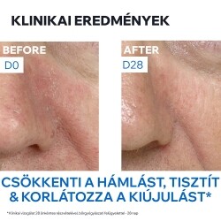 URIAGE Rutin sebhorreas dermatitisz kiegészítő ápolására